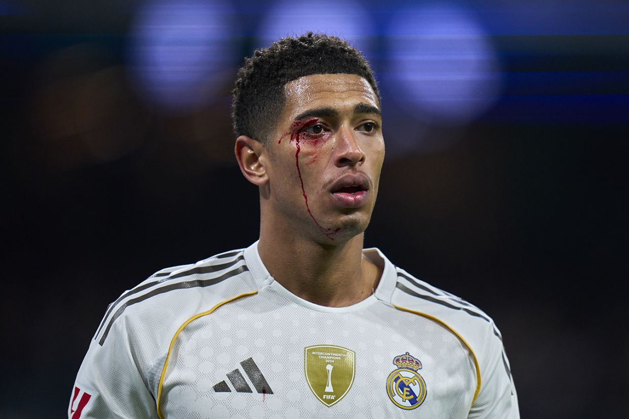 Jud Bellingemin qaşı partlasa da oyunu davam etdirib