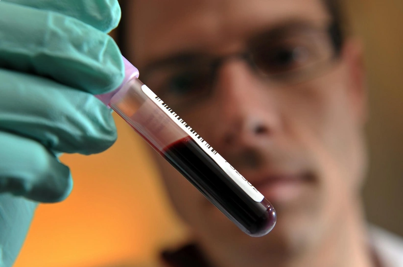 Azərbaycan idmançısı 2 illik diskvalifikasiya olunub