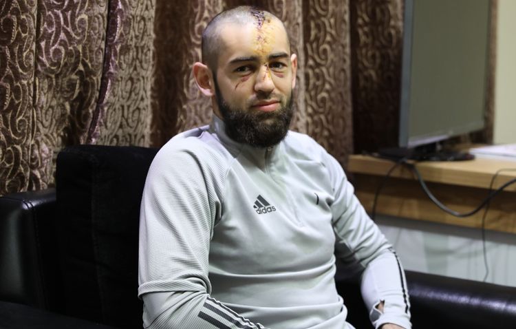 "Şah"la Portuqaliyaya qarşı çıxışından zədələrədək səmimi söhbət: "Allah çox qorudu məni - gözsüz qala, hətta ölə bilərdim"