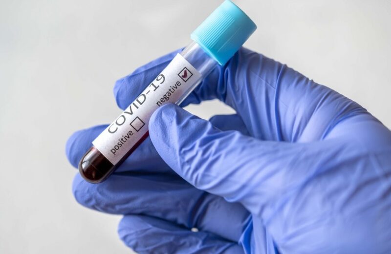 Millinin baş məşqçisi koronavirusa yoluxdu